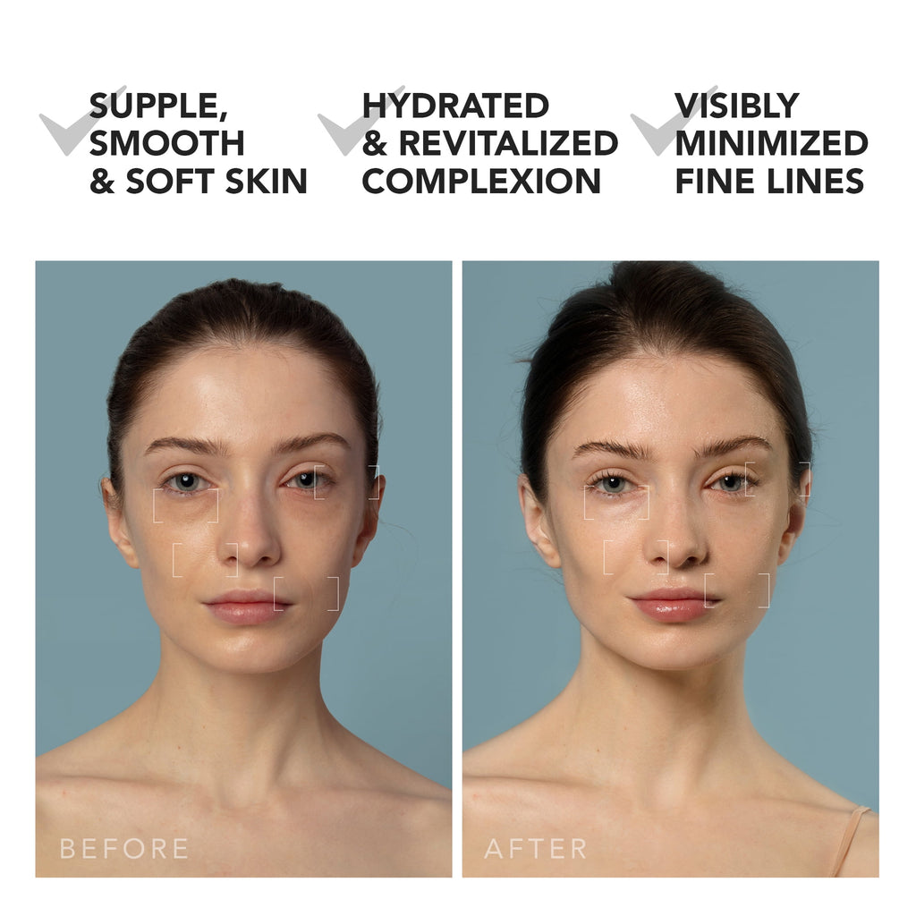 FOREO UFO 3 - LED Facial Treatment Device with T-Sonic and Mask Care Technology - Black